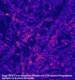 Image FFOCT d'un échantillon diffusant avec 0.26 microns d'astigmatisme (...)