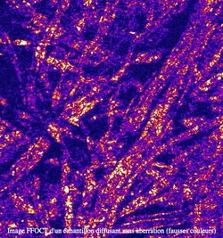 Image FFOCT d'un échantillon diffusant sans aberration (fausses (...)