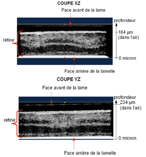 Coupes axiales d'une rétine explantée de rat entre lame et lamelle.